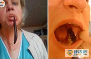 女子让水蛭爬满全身“排毒” 称能减肥提高性欲 女子让水蛭爬满全身“排毒” 称能减肥提高性欲