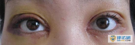 22Ůںݵ˫ƤѪ ˵ʱ귽ݵϰ