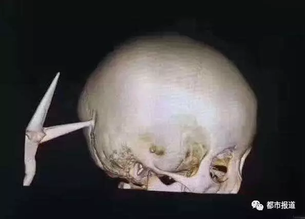 פ4ܵ⽫6ͷ ҹתԺȣͼ