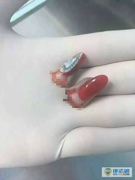 ֲ!һ19ʦ ָ˲קֳѪ죡ҽƶָѪȫֲͼ