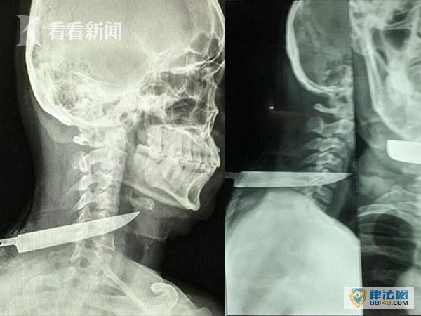 կһλĸͽ⵶͸ ༹1漣ͼ