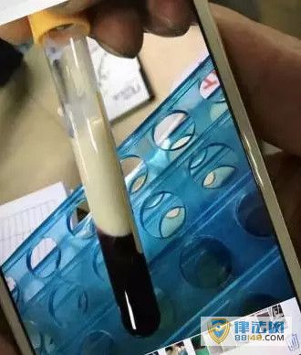 Ѫ ĸȴ16ӣͼ 